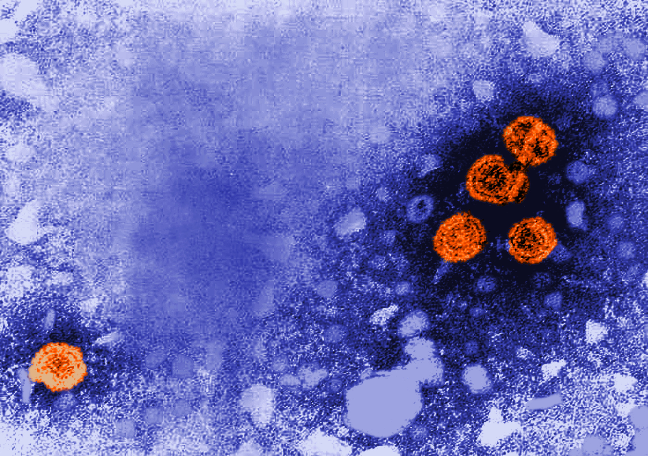 HBV micrograph